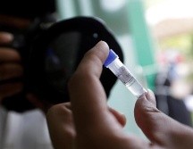 Ciudadanos han denunciado que el Laboratorio Nacional demora hasta ocho días en dar los resultados de las pruebas. EFE/H. Simanjuntak