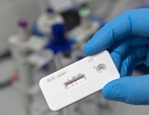 En Jalisco se realizan mil 500 pruebas diarias (entre rápidas y PCR). AP /ARCHIVO