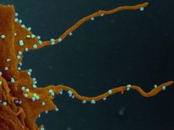 La célula infectada, siguiendo las instucciones del virus (en azul), desarrolla largos tentáculos para infectar otras células. ELIZABETH FISCHER, MICROSCOPY UNIT NIH/NIAID