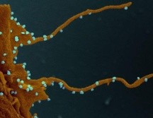 La célula infectada, siguiendo las instucciones del virus (en azul), desarrolla largos tentáculos para infectar otras células. ELIZABETH FISCHER, MICROSCOPY UNIT NIH/NIAID