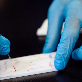 Reportan a menor de siete años con dengue y COVID-19 en BCS