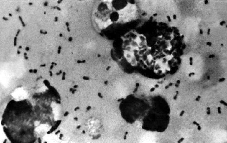 La peste bubónica se caracteriza por la inflamación de los ganglios linfáticos. GETTY IMAGES /