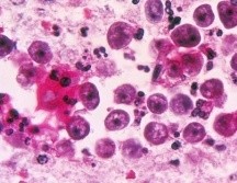 La ameba entra al organismo por la nariz y de allí migra hacia el cerebro. SCIENCE PHOTO LIBRARY