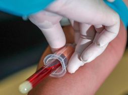 Guadalajara, Tlaquepaque, Puerto Vallarta y Zapopan son los municipios con mayor número de defunciones. EFE/M. Cristino