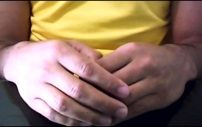 La imagen muestra las manos del paciente. 