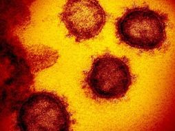 Muchos laboratorios han elegido una proteína que se encuentra en la corona de virus como blanco para neutralizar sus efectos. GETTY IMAGES