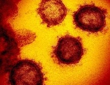 Muchos laboratorios han elegido una proteína que se encuentra en la corona de virus como blanco para neutralizar sus efectos. GETTY IMAGES