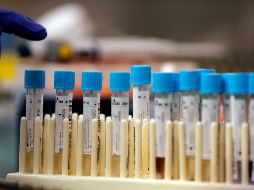 Poblaciones como Talpa, Jamay, Ojuelos, Mezquitic o Magdalena; han reportado menos casos que los que hay en el Congreso Estatal. AP/ARCHIVO