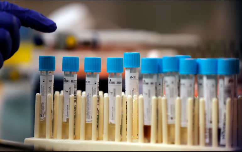 Poblaciones como Talpa, Jamay, Ojuelos, Mezquitic o Magdalena; han reportado menos casos que los que hay en el Congreso Estatal. AP/ARCHIVO