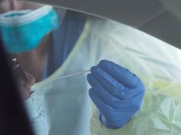 Dos de los pacientes requirieron hospitalización y el resto se recuperó de forma ambulatoria. EFE/C. Gunther