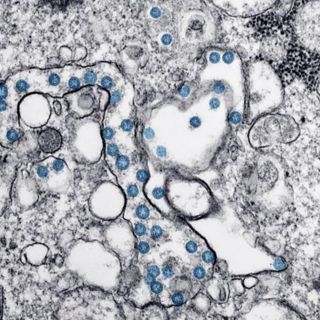 Rusia promete miles de vacunas del COVID-19 desde finales de 2020