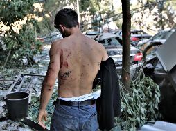 Hasta este miércoles, las explosiones han dejado un saldo de 113 muertos y cuatro mil heridos. Hay decenas de personas desaparecidas. EFE / EPA / N. Mounzer