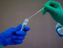 Algunos funcionarios de salud y del gobierno notan una creciente frustración del público y una menor demanda en la aplicación de pruebas. EFE/E. Fontcuberta