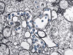 Los científicos planean sumar a su estudio la colaboración de los farmacólogos de la Universidad de Northwestern para diseñar un nuevo fármaco. AFP / ARCHIVO