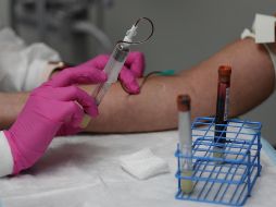 El Departamento de Salud Pública del Condado de El Dorado informó la noche del lunes que recibieron la notificación de una prueba positiva a la enfermedad. AFP/ARCHIVO