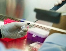 Los investigadores analizaron una base de datos de 159 pacientes con lupus y artritis y que también presentaban COVID-19. EFE/ARCHIVO