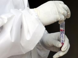 El promedio nacional en costo por COVID-19 para las aseguradoras se mantiene en 398 mil pesos. EFE/J. Nv