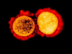 Los investigadores señalaron que un análisis genético mostró que las dos infecciones sucesivas fueron causadas por dos cepas diferentes del virus SARS-CoV-2. AFP/NIAID/ARCHIVO