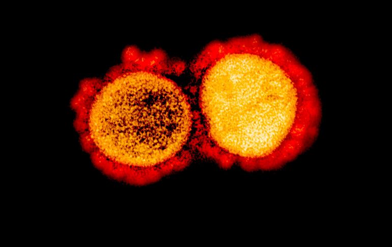 Los investigadores señalaron que un análisis genético mostró que las dos infecciones sucesivas fueron causadas por dos cepas diferentes del virus SARS-CoV-2. AFP/NIAID/ARCHIVO