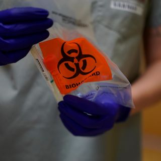 Hidrocortisona reduce la mortalidad de enfermos graves de COVID-19, según un estudio