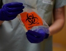 Las pruebas realizadas en 88 hospitales británicos revelaron la eficacia de la hidrocortisona, que podría salvar a uno de cada 12 pacientes. AP / ARCHIVO