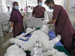 Al menos 37 personas ingresaron a una unidad de quemaduras en un hospital de Daca, la capital. AP/A. Goni