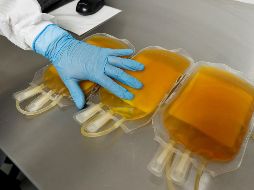 El plasma es la parte líquida de la sangre la cual se obtiene después de un proceso de centrifugación.EFE/J. Méndez