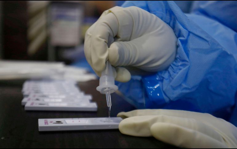 Se trata de la primera prueba de este tipo en Italia, y tras su u aprobación por el Ministerio de Sanidad ya está lista para entrar en producción. EFE / F. Khan