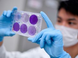 AstraZeneca interrumpió sus ensayos tras presentar una reacción adversa “inesperada” en uno de los voluntarios. AFP / D. Magno