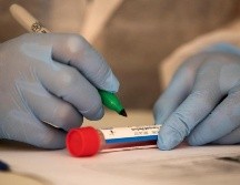 Las personas menores de 20 años representaron menos del 10% de los casos y menos del 0.2% de las muertes. EFE/O. Barría