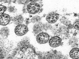 El nuevo coronavirus muta dos veces menos rápidamente que la gripe y cuatro veces menos que el VIH. AP / C.S Goldsmith, A. Tamin