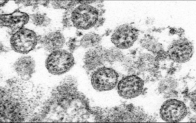 El nuevo coronavirus muta dos veces menos rápidamente que la gripe y cuatro veces menos que el VIH. AP / C.S Goldsmith, A. Tamin