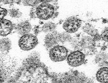El nuevo coronavirus muta dos veces menos rápidamente que la gripe y cuatro veces menos que el VIH. AP / C.S Goldsmith, A. Tamin