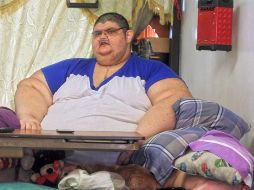 Juan Pedro considera que el complejo tratamiento que atravesó para perder peso le ayudó a vencer el coronavirus. EL INFORMADOR/ARCHIVO