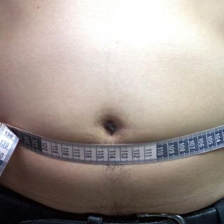 Obesidad mórbida en adultos multiplicaría riesgo grave de coronavirus