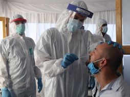 La prueba múltiple detecta otros virus como adenovirus, influenza A, influenza A H1N1, influenza B y parainfluenza. EFE/K. Elfiqi