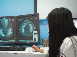 MASTÓGRAFO DIGITAL. La Secretaría de Salud Jalisco informó de la  inversión de casi tres millones de pesos en un aparato que duplicará la atención. ESPECIAL