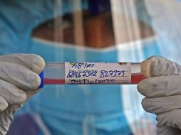 La universidad Johns Hopkins contabiliza mil 021 muertes en las últimas 24 horas. EFE/ARCHIVO