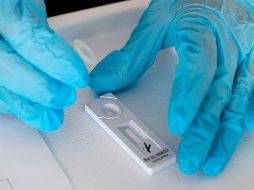 La tasa de positivos en Francia se sitúa en 20.3 por ciento. AFP