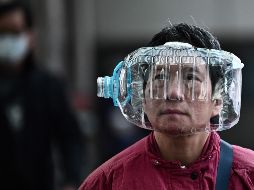 Seis meses después del comienzo de los síntomas, cerca de la mitad de los pacientes presentaban al menos un patrón no normal en las tomografías computerizadas. AFP / A. Wallace