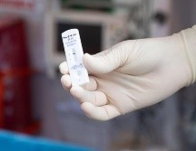 Se han registrado mil 216 casos positivos al SARS-CoV-2 entre personal de salud jalisciense. EFE