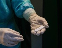 La variante afecta a un mayor número de pacientes más jóvenes, sin comorbilidades, que desarrollan formas graves de la enfermedad. EFE/T. Romano