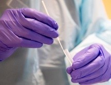 A la fecha se reportan 97 municipios con casos activos. EFE/A. Ihse