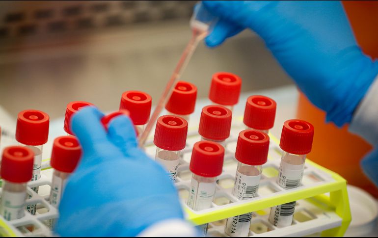 En Jalisco, cuatro de cada 10 pruebas PCR para detectar COVID-19 se pagaron en laboratorios particulares. EL INFORMADOR/ARCHIVO
