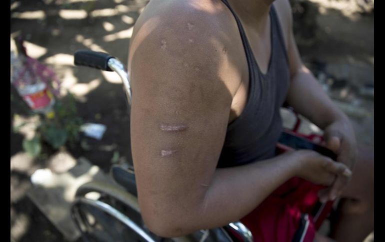 A pesar del miedo, los entrevistados se dijeron esperanzados de que pronto el régimen sandinista se desintegre. EFE/J. Torres