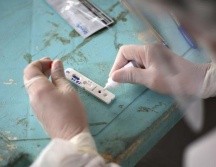 La investigación sobre la nueva variante se hizo con 31 muestras de pacientes con covid-19 en la capital de Amazonas. GETTY IMAGES