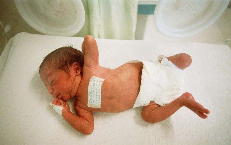 El bebé prematuro nació el  jueves pasado en un hospital privado de Tecámac, Estado de México, con el apoyo de autoridades municipales . EL INFORMADOR/ARCHIVO