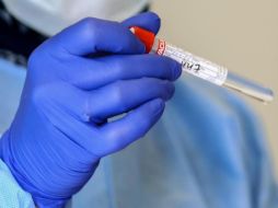 La entidad jalisciense se mantiene en el segundo lugar nacional por pruebas realizadas, sólo precedida por la Ciudad de México. EFE