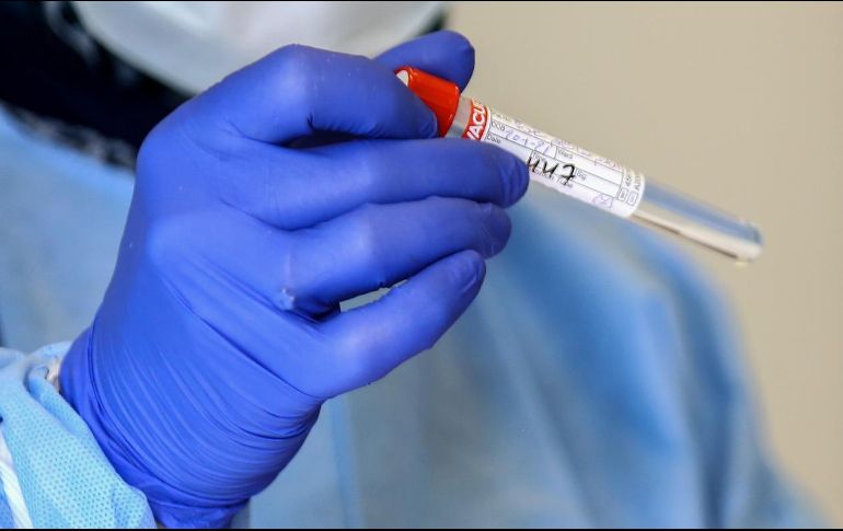 La entidad jalisciense se mantiene en el segundo lugar nacional por pruebas realizadas, sólo precedida por la Ciudad de México. EFE