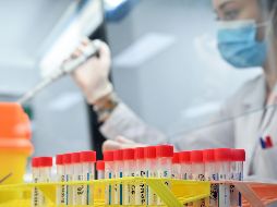 Las variantes son versiones diferentes del coronavirus inicial, que aparecen con el tiempo, a causa de varias mutaciones. Es un fenómeno normal en la vida de cualquier virus. AFP / J. Tallis